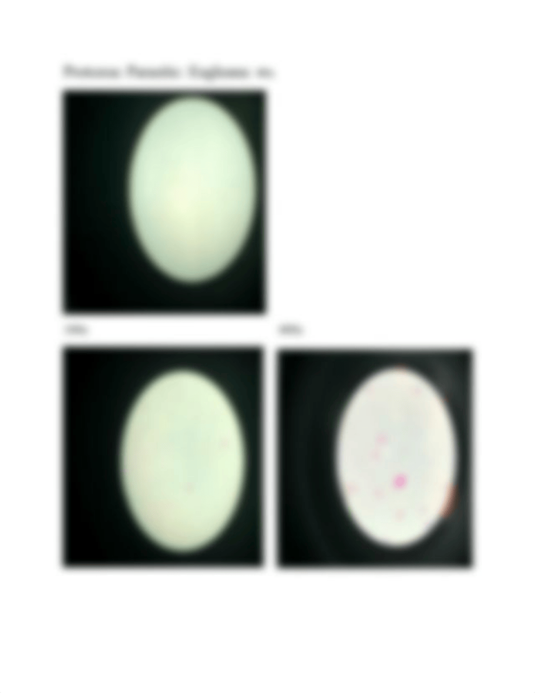 Lab Slides Microbiology Fungi Yeast Molds Protozoa.docx_dftaw95yih0_page4