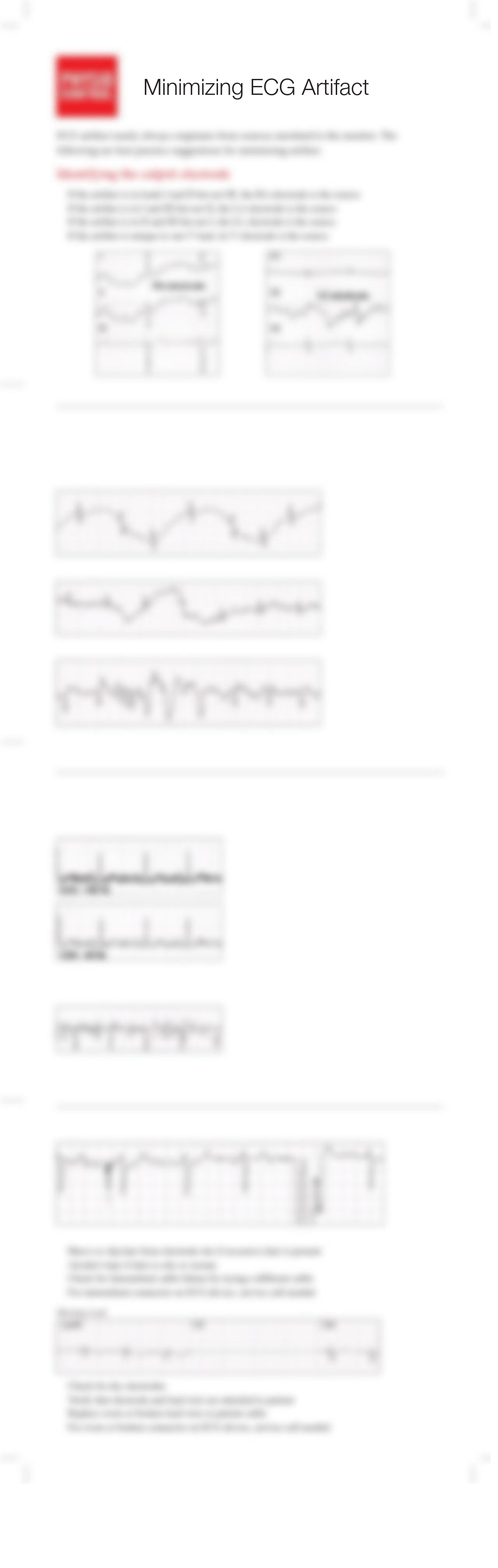 Minimizing ECG Artifact guide 3306627_A_HR.pdf_dfttmxabeua_page1