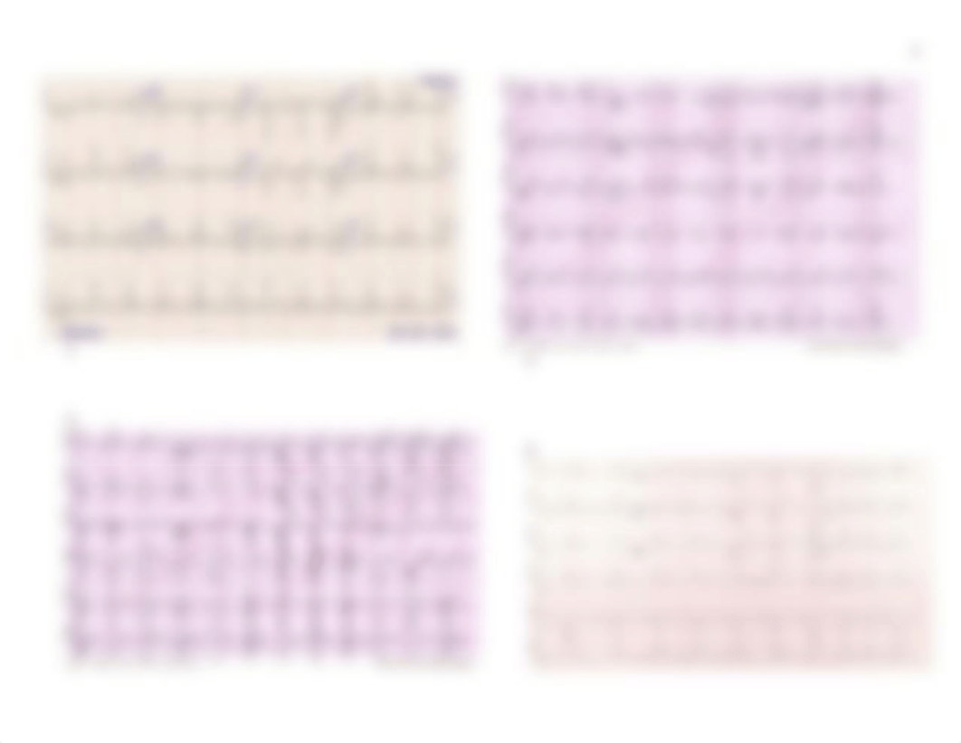 Steps for 12 Lead ECG InterpD_T (1).docx_dfvqgqqho1z_page2