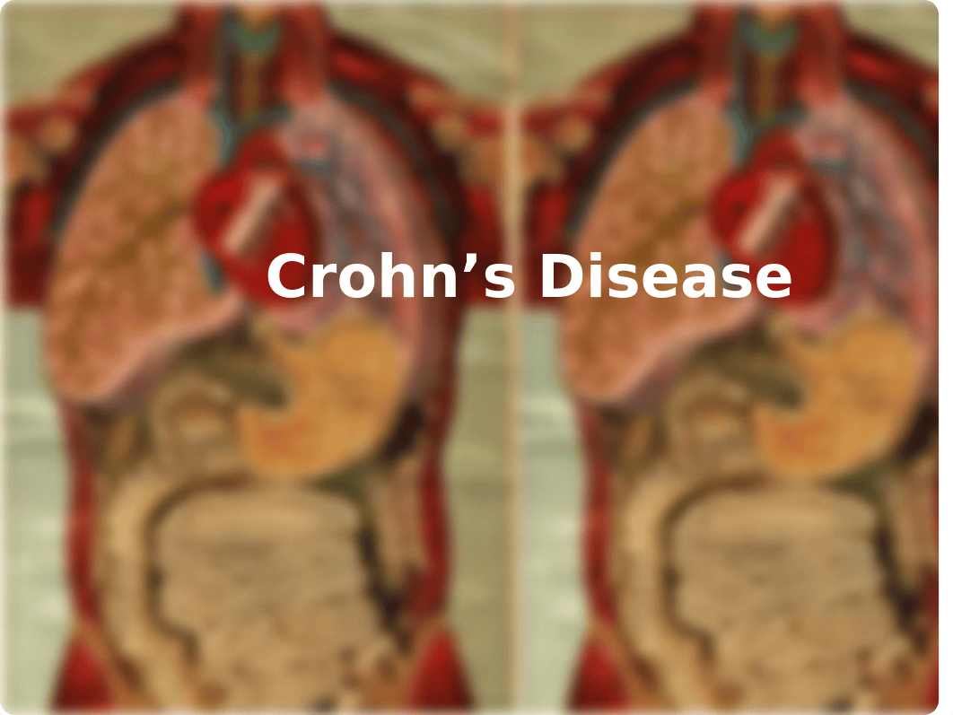 crohns-case-study student ppt.pptx_dfxvtg949t8_page1