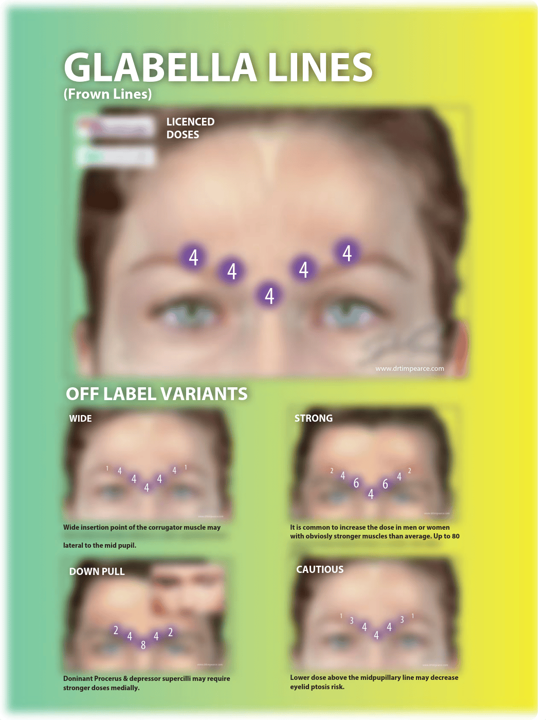 26-Essential-Botox-Injection-Patterns.pdf_dfzd4phu87d_page2