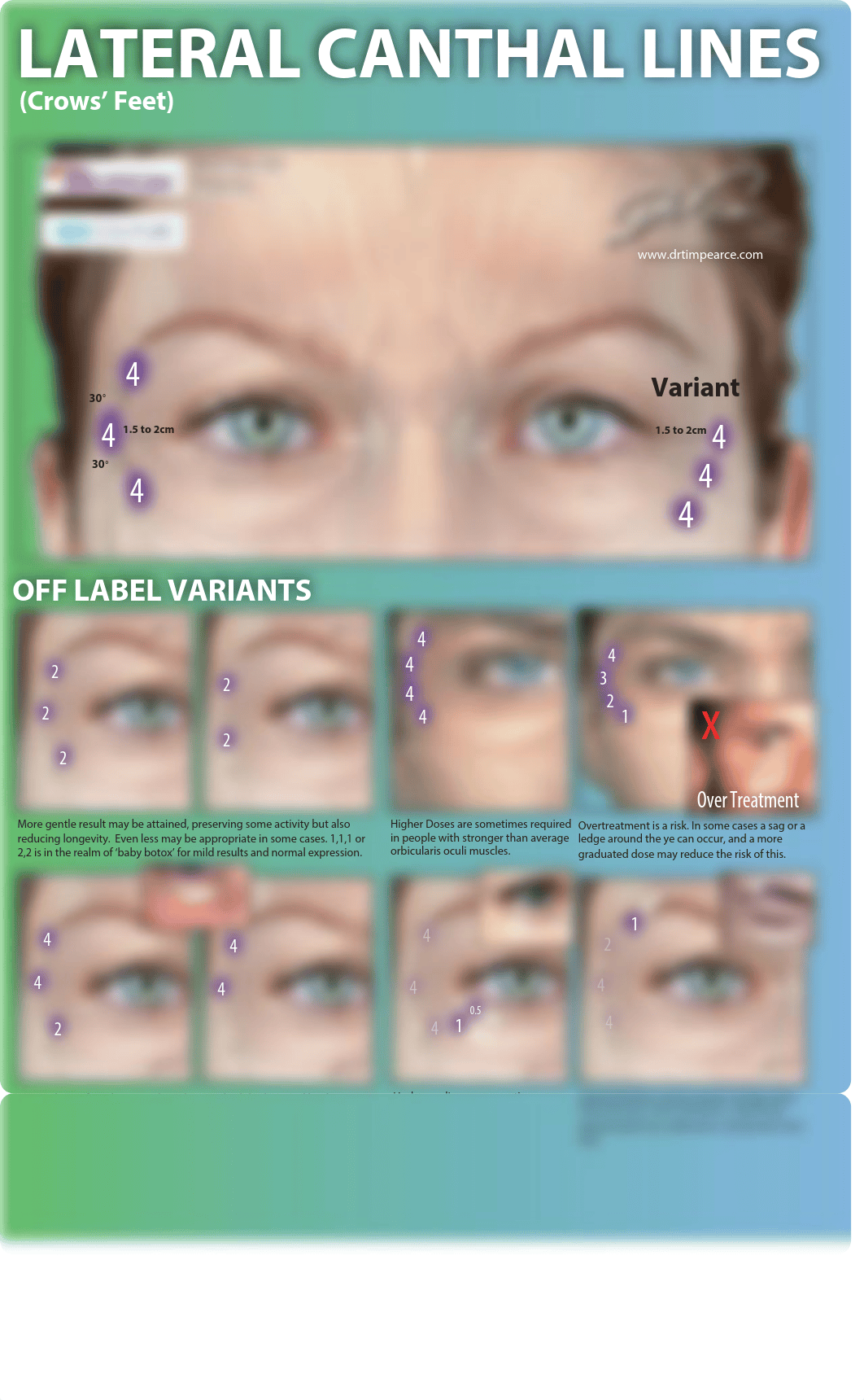 26-Essential-Botox-Injection-Patterns.pdf_dfzd4phu87d_page3