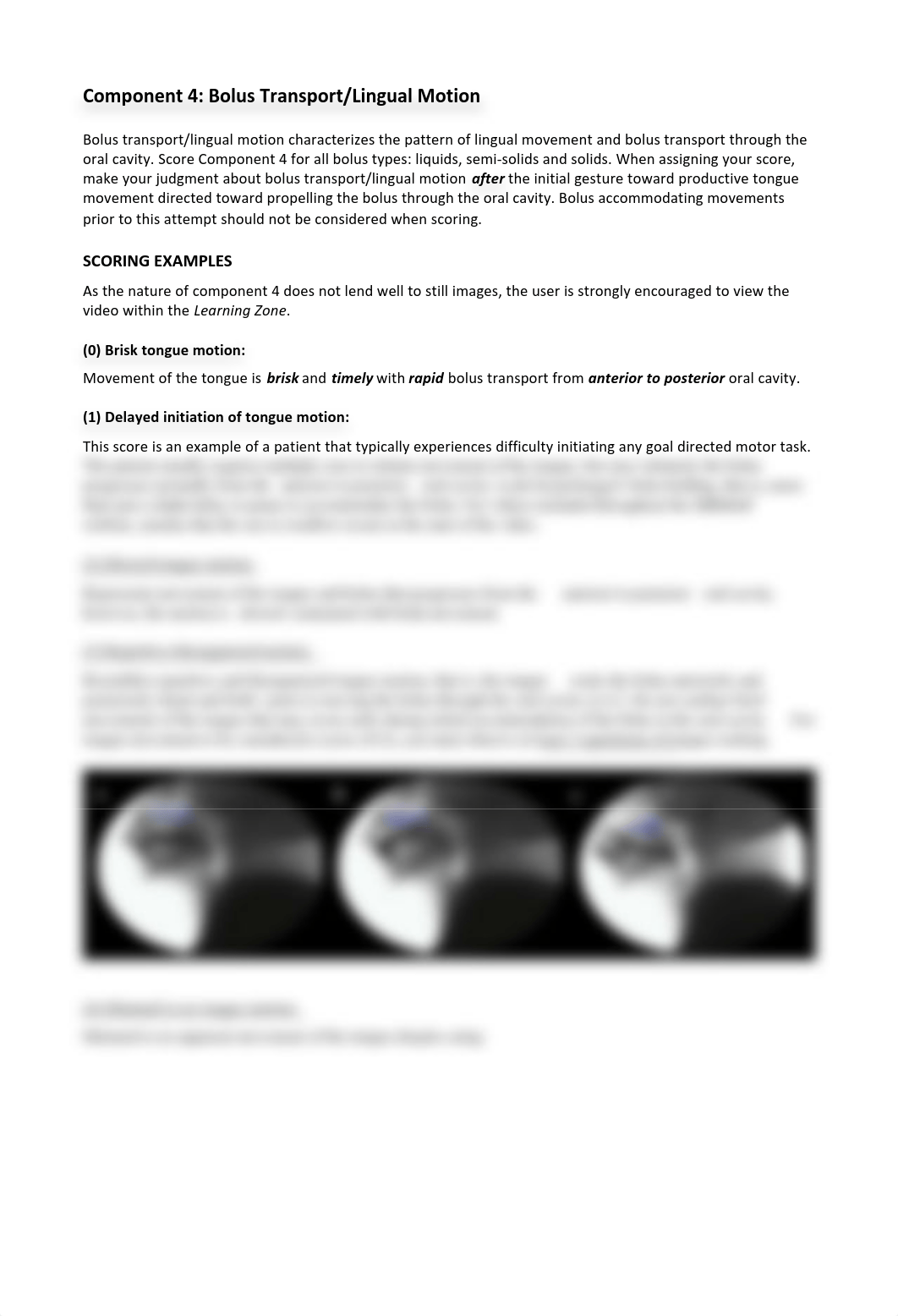 4-Bolus_Transport_Lingual_Motion MBS.pdf_dg2p5ka2trc_page1