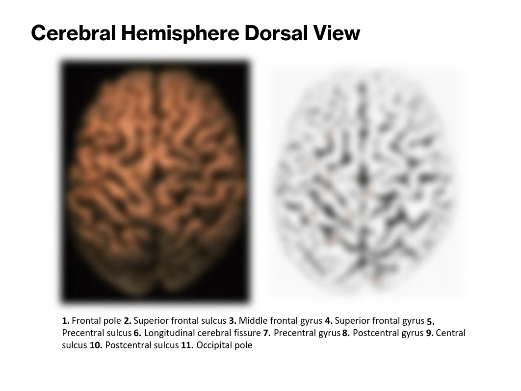 View of the Human Brain_dgct0b9vvrl_page2