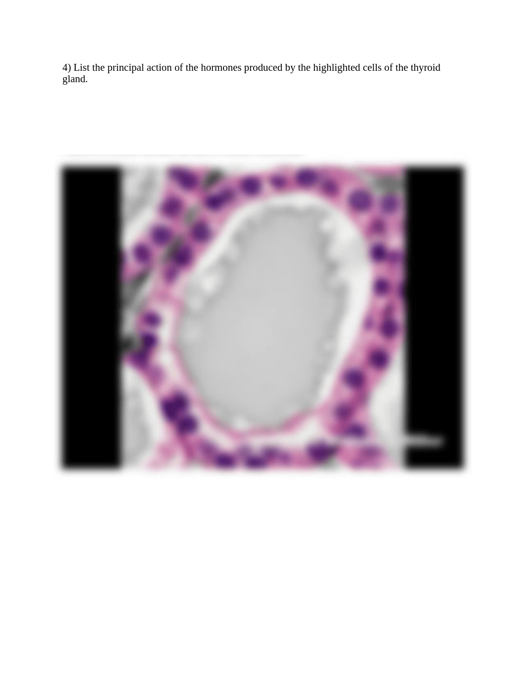 Hormone actions no ans worksheet.docx_dgfo2yn9nxu_page4