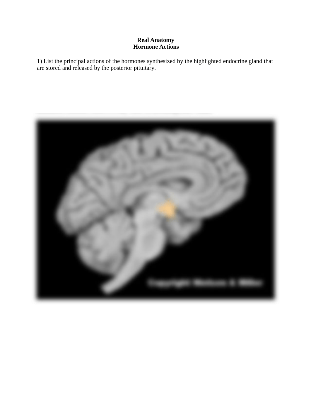 Hormone actions no ans worksheet.docx_dgfo2yn9nxu_page1