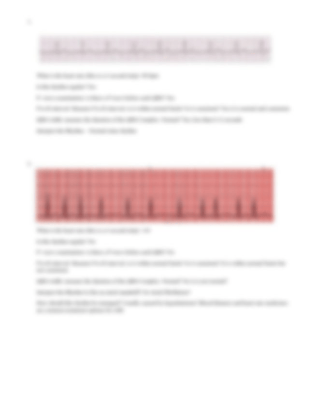 NU372 Dysrhythmia Worksheet.docx_dghk9pwunpw_page2