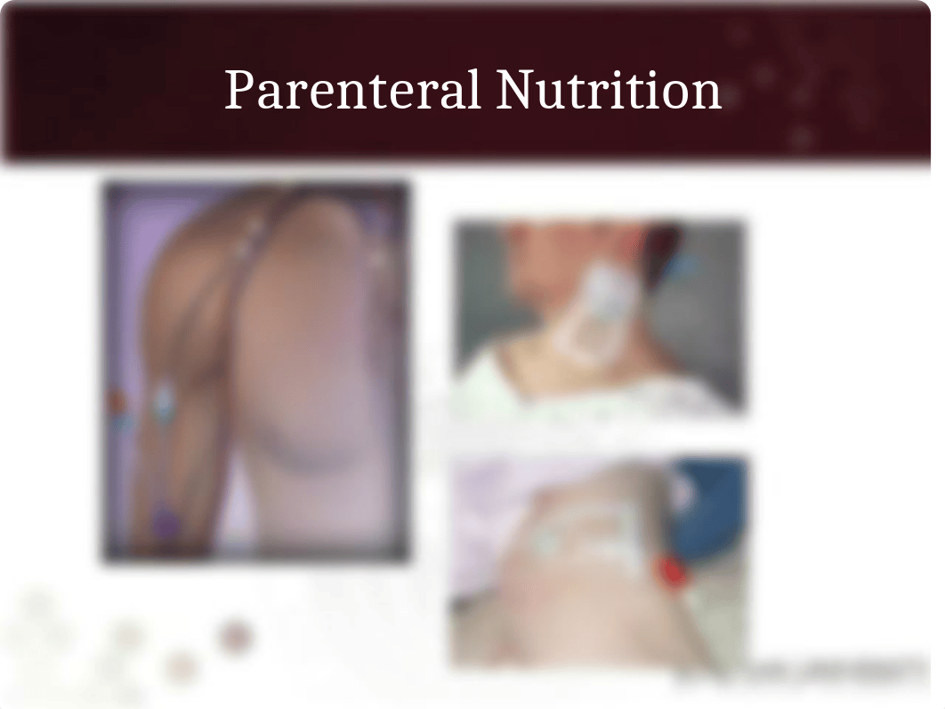 Block 10 Parenteral Nutrition(1).pptx_dgl7fo5tcpl_page5