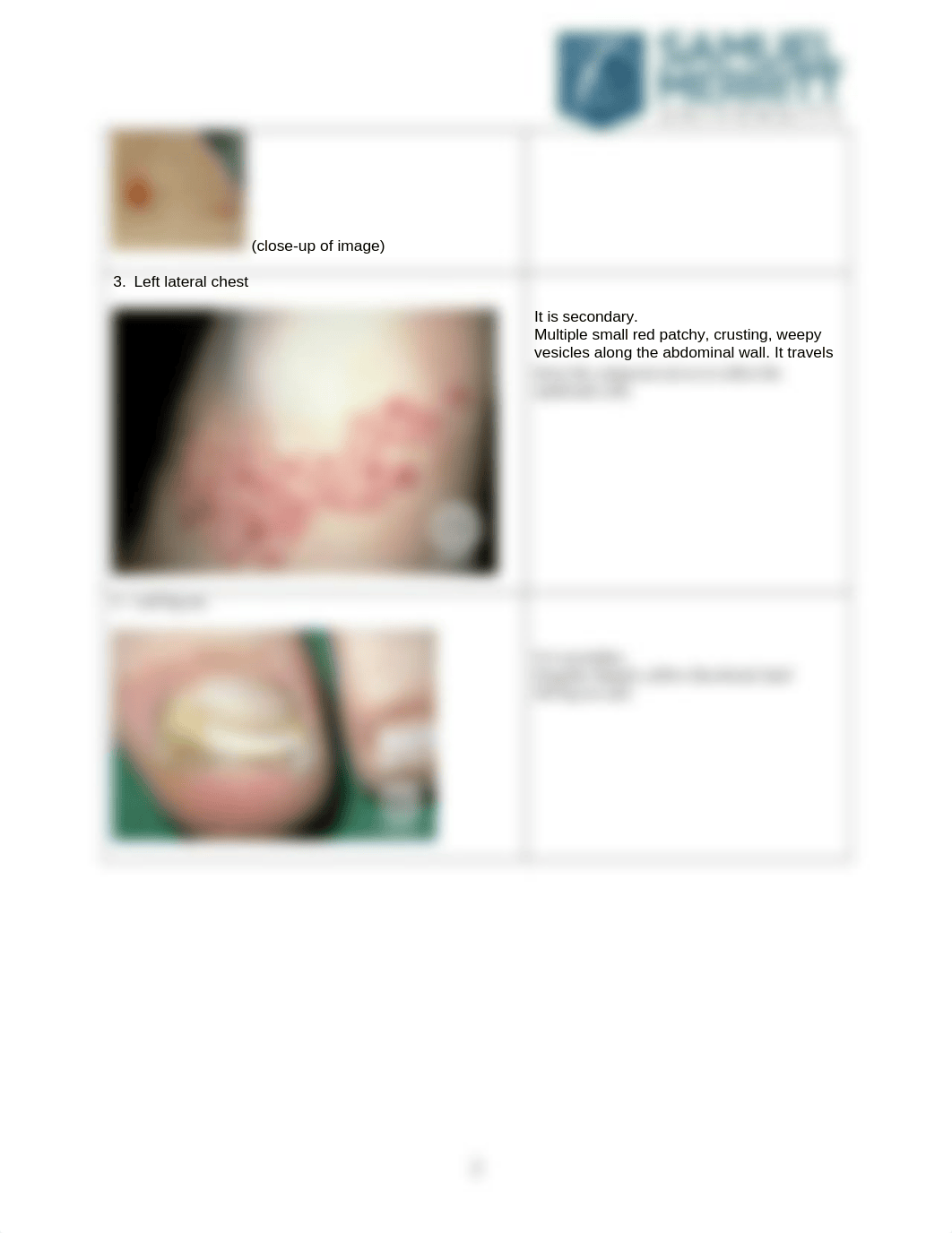 NUR671L-Dermatologic_Conditions_Descriptions_Worksheet .docx_dgnib3gszfk_page2