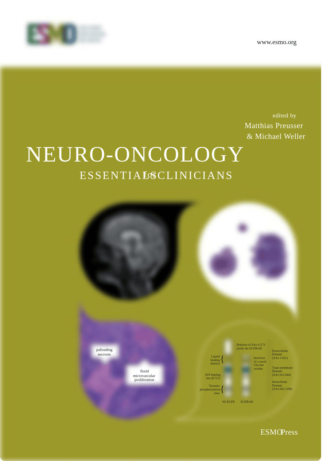 2017-ESMO-Essentials-for-Clinicians-Neuro-Oncology.pdf_dgqiwpbr2ne_page1