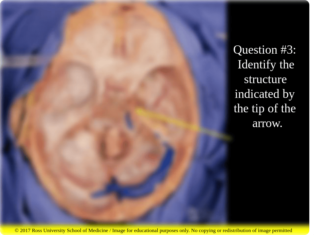 Skull and Cranial Fossa (post class assessment).pdf_dgv7rnxmmvn_page5