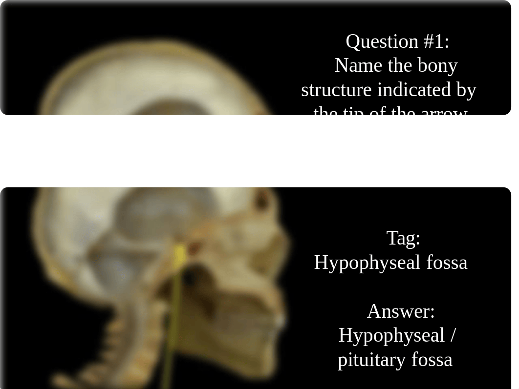 Skull and Cranial Fossa (post class assessment).pdf_dgv7rnxmmvn_page2