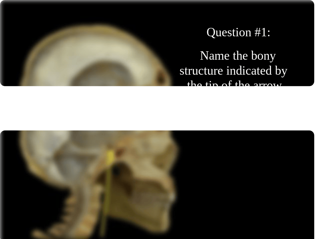 Skull and Cranial Fossa (post class assessment).pdf_dgv7rnxmmvn_page1