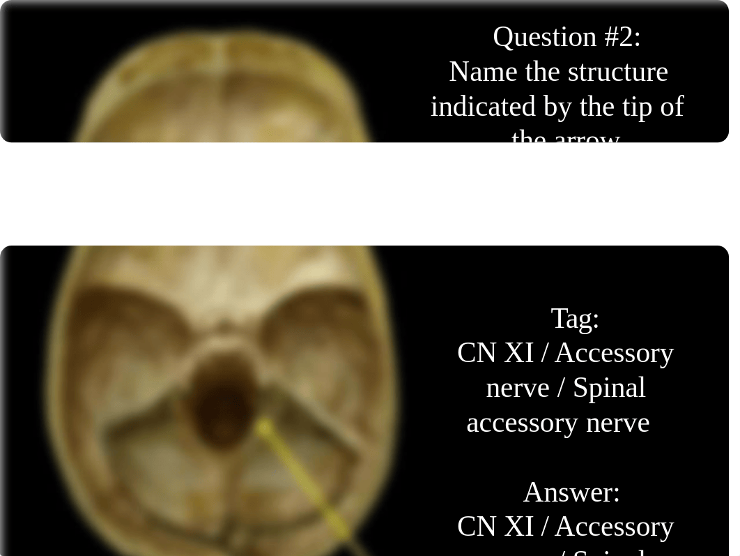 Skull and Cranial Fossa (post class assessment).pdf_dgv7rnxmmvn_page4