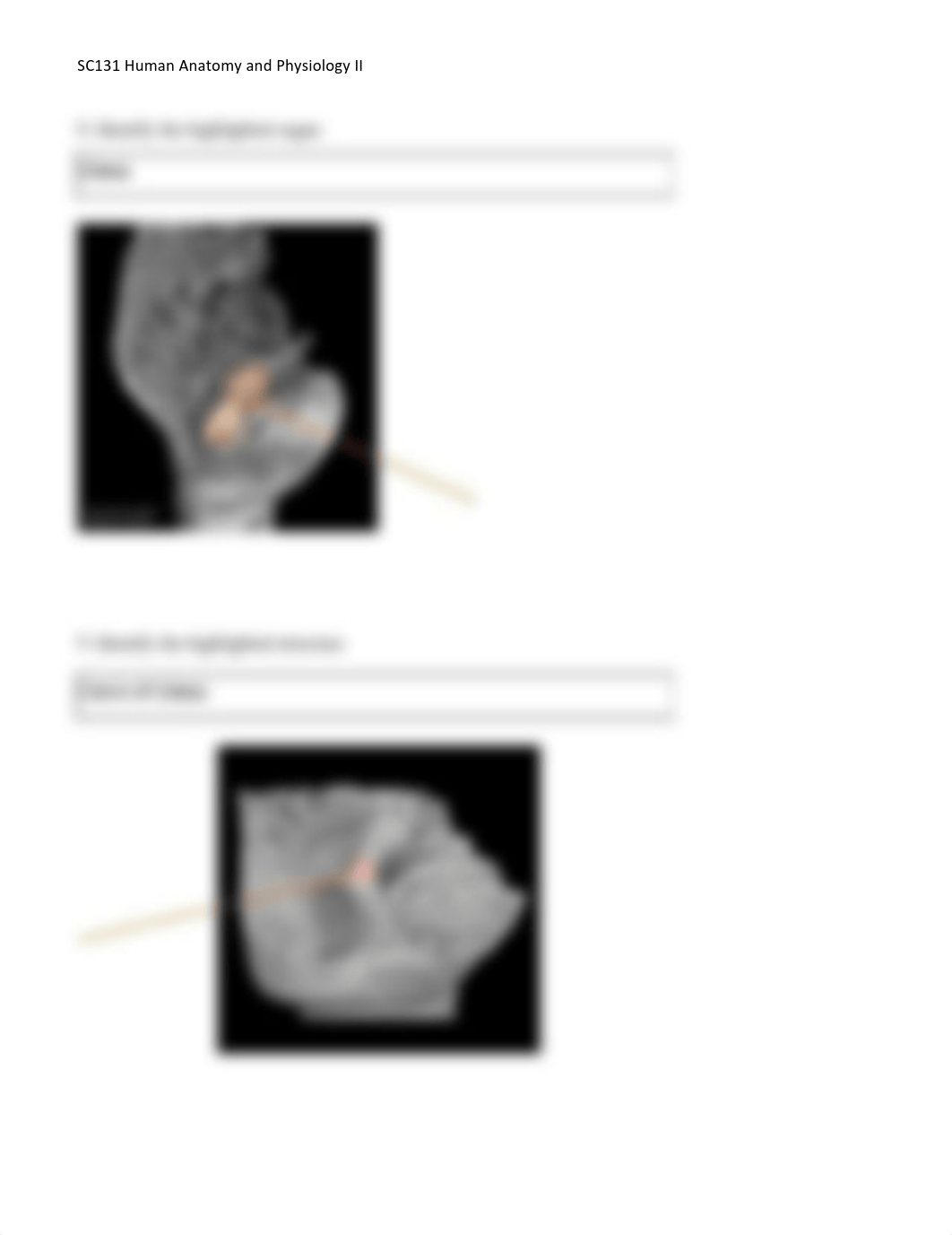 Unit 8 Assignment _ Lab Worksheet - Male and Female Reproductive_dgvk4335ahi_page5