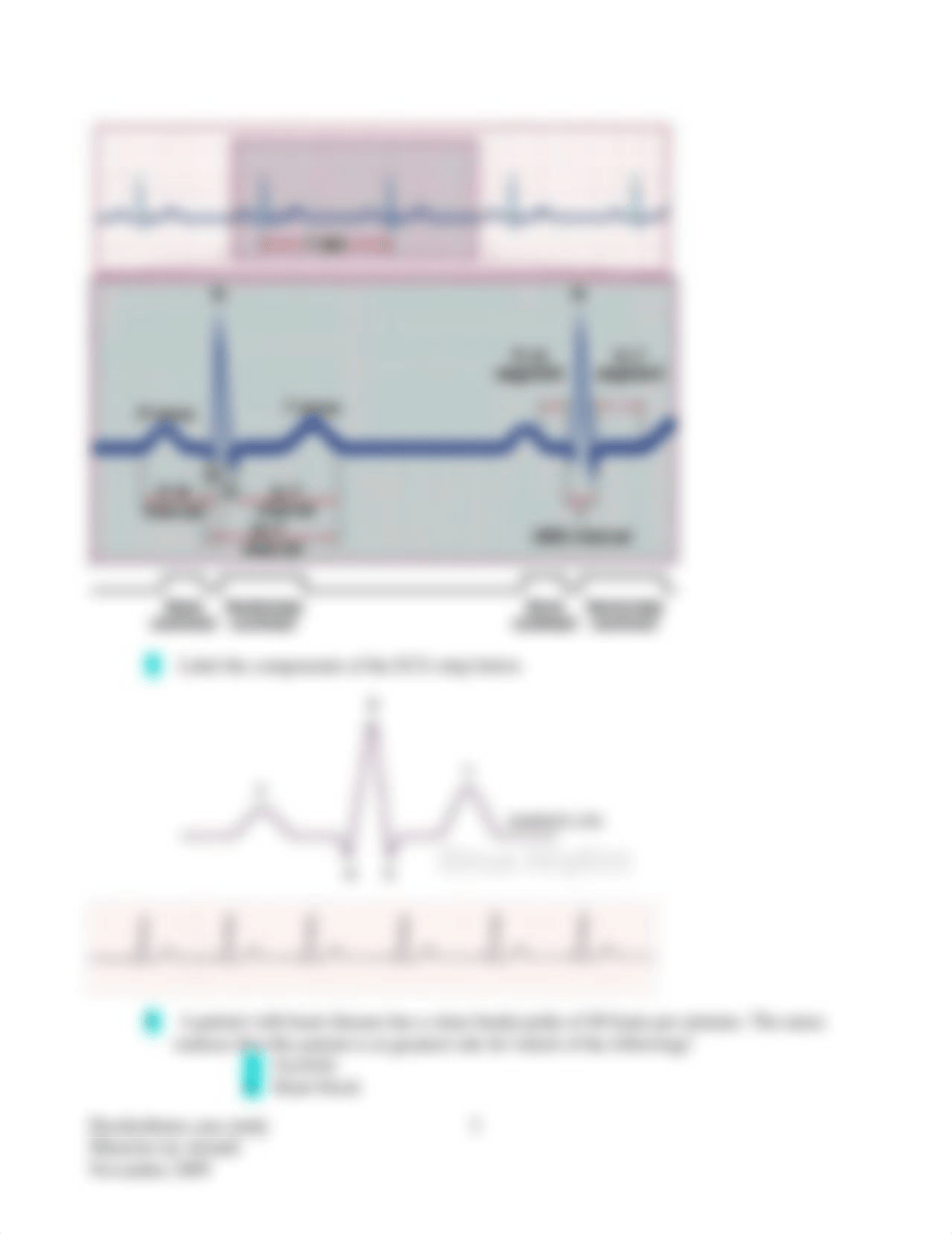 Dysrhythmias Case study      ANSWERS    Fall 2009 (3).doc_dgz9h5a1zfv_page3