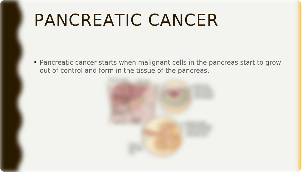 Pancreatic cancer .pptx_dh32j0cot3u_page2