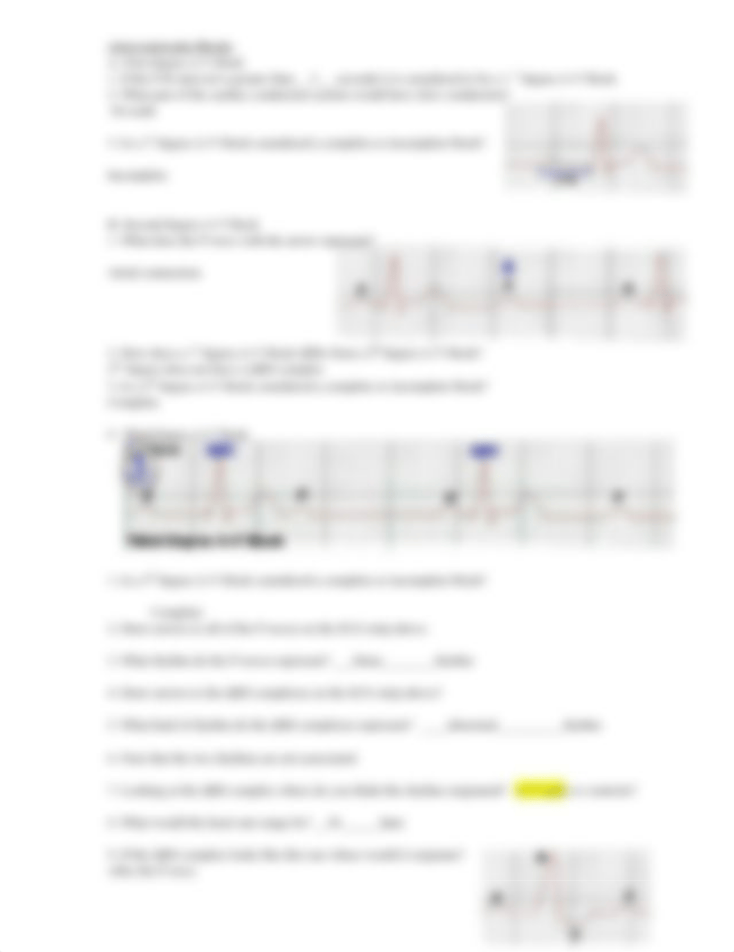 Lecture Exit Questions6.Arrythmias.Worksheet.doc_dh3wq1qnxww_page2