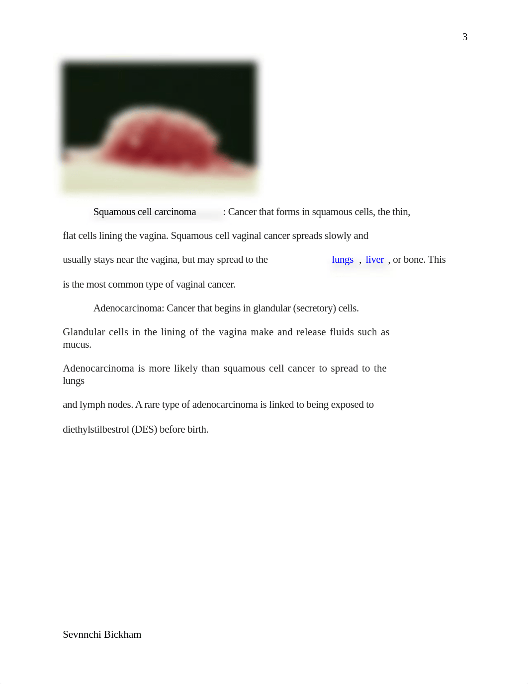 Vaginal Cancer.docx_dh53ig5uf5t_page3