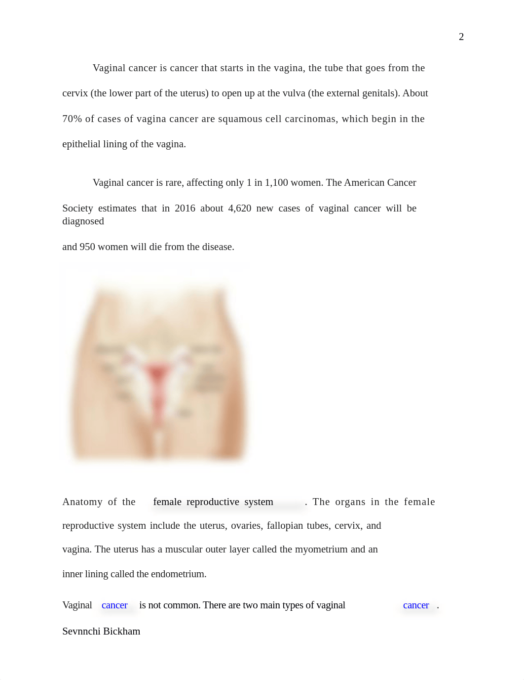 Vaginal Cancer.docx_dh53ig5uf5t_page2