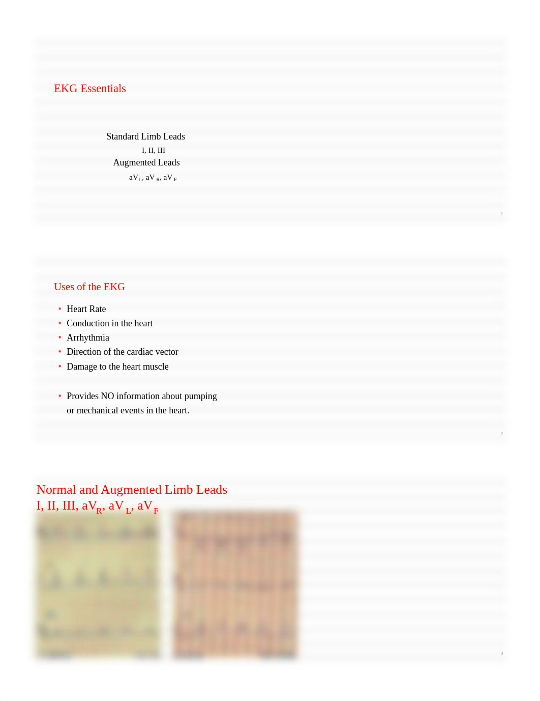 10.17 - Thompson - EKG Essentials_dh64w8juxd7_page1