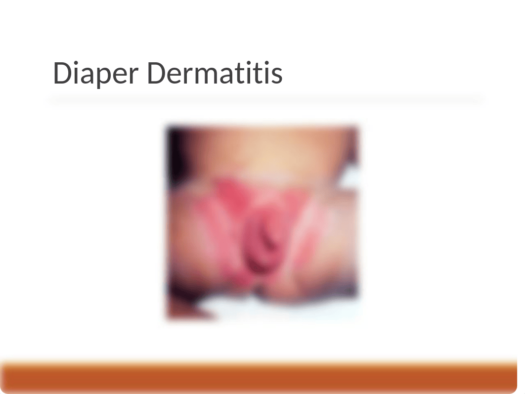 Skin Disorders and Burns.ppt_dhbf2i4k6aj_page4