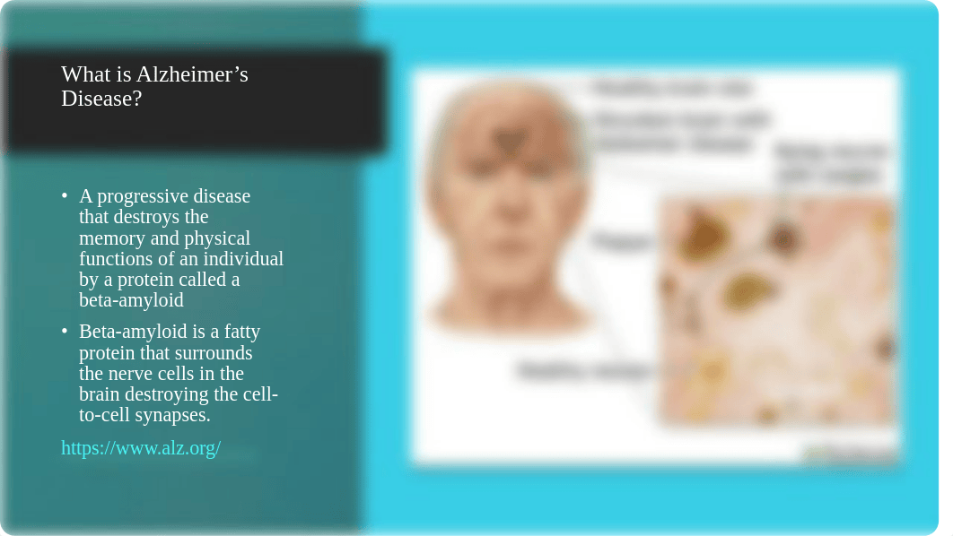 Alzheimer's Disease powerpoint2.pptx_dhbh9s326x9_page2