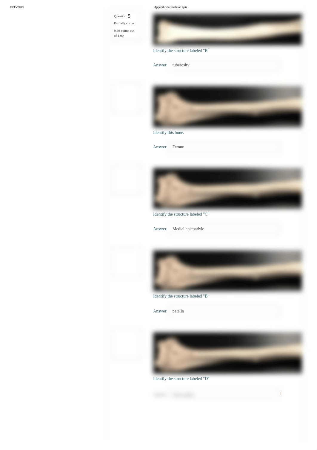 Appendicular skeleton quiz.pdf_dhbha3mmj1r_page2