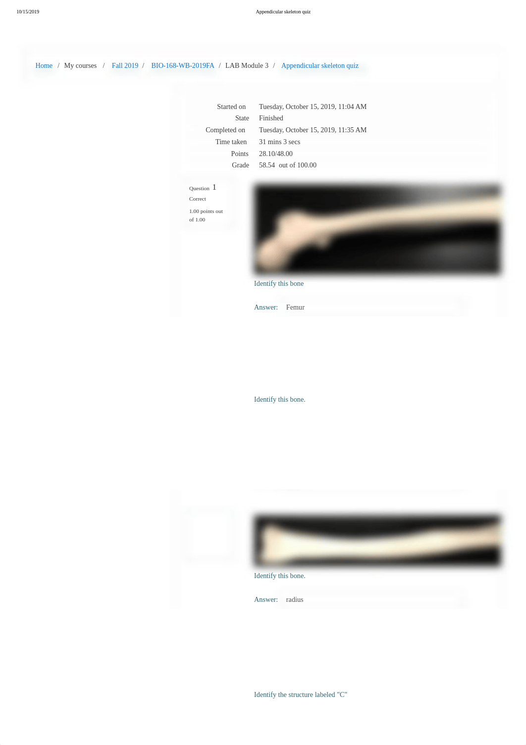 Appendicular skeleton quiz.pdf_dhbha3mmj1r_page1