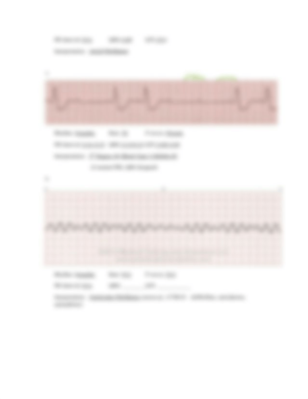 ECG Practice Exam Review.docx_dhjmy7fvbj6_page3