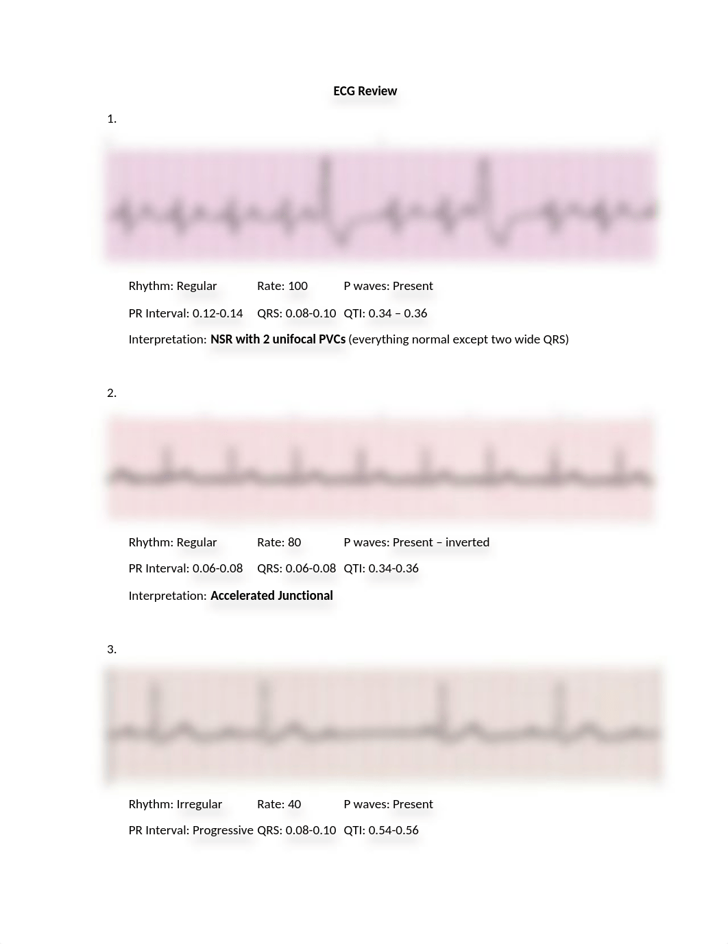 ECG Practice Exam Review.docx_dhjmy7fvbj6_page1