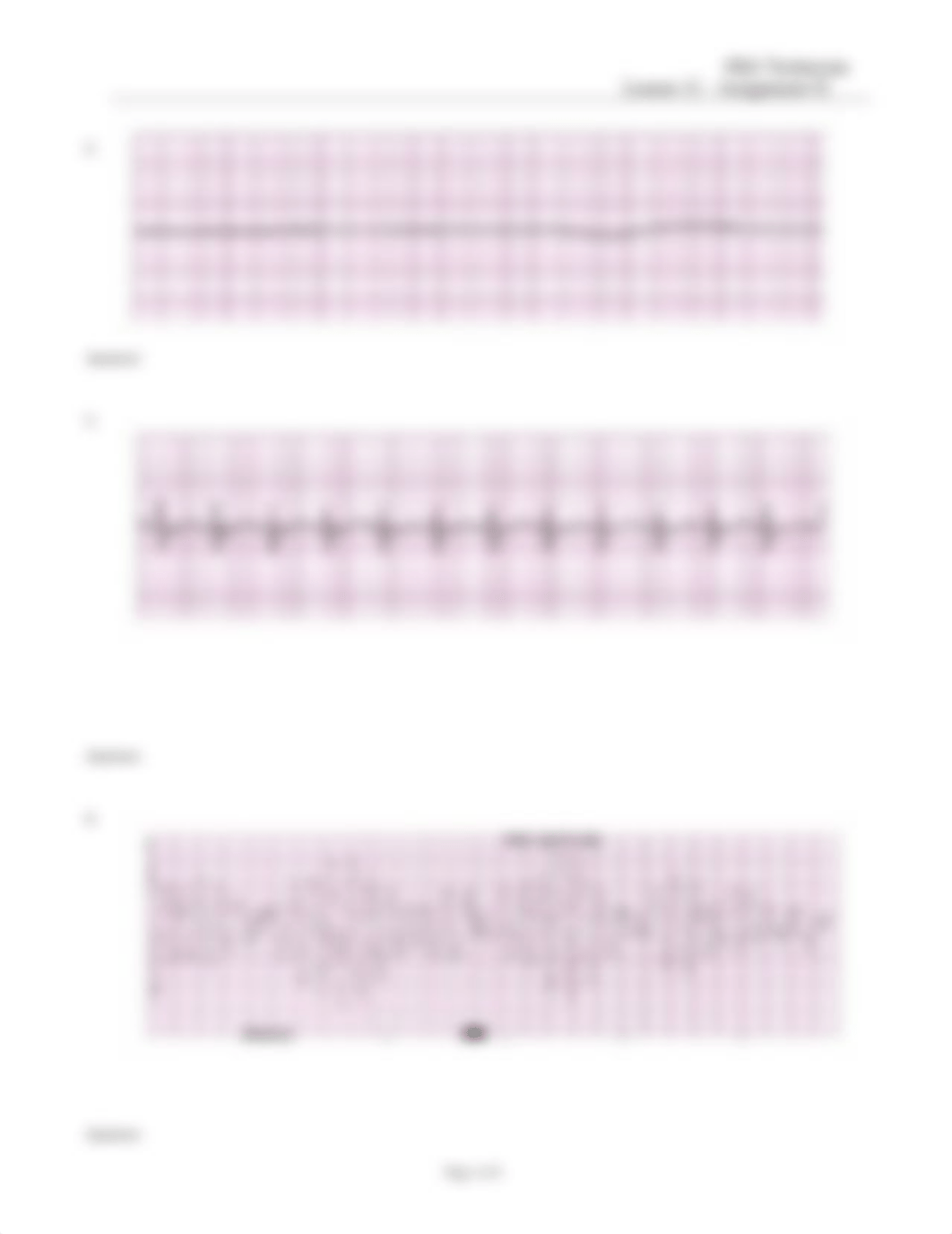 EKG Technician Lesson 12 Assignment Two 042116(1).doc_dhjx4jqur1v_page2