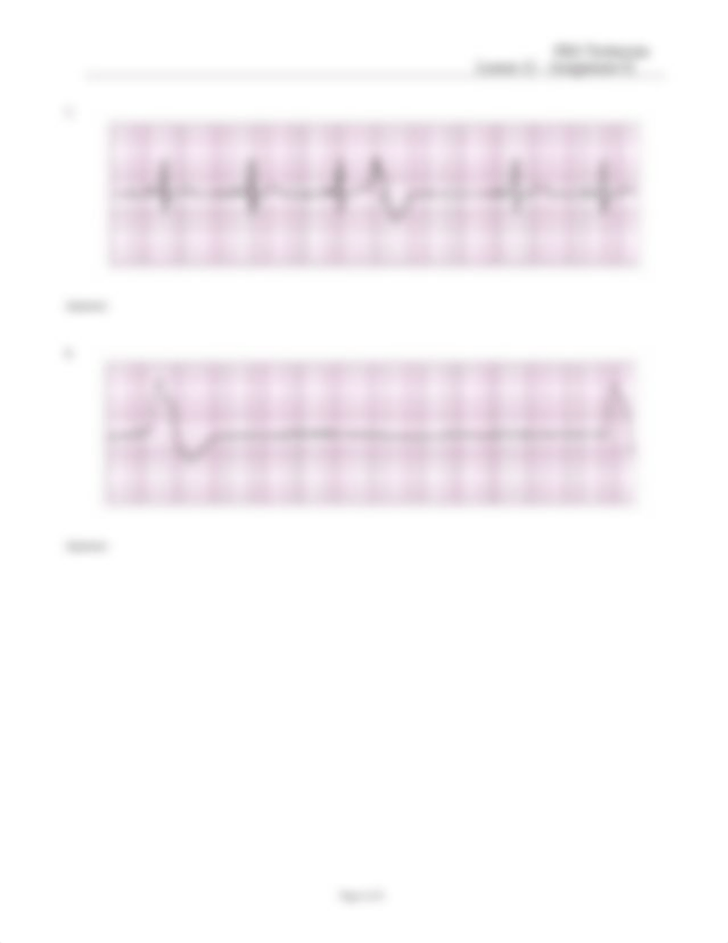 EKG Technician Lesson 12 Assignment Two 042116(1).doc_dhjx4jqur1v_page4