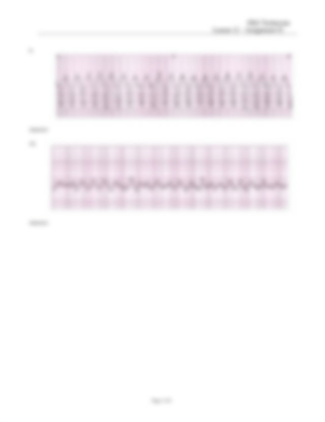 EKG Technician Lesson 12 Assignment Two 042116(1).doc_dhjx4jqur1v_page5