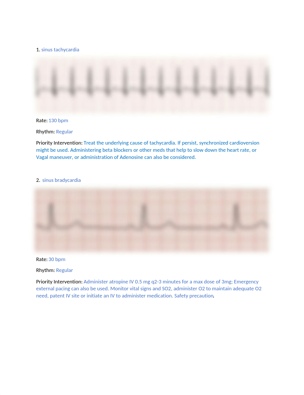 EKG Assignment.docx_dhlqaw3aroa_page1