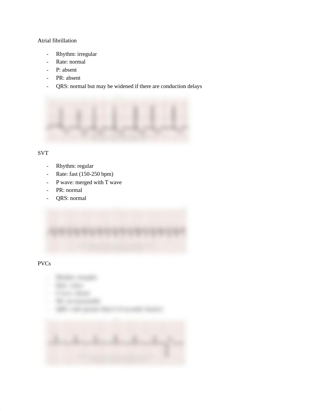 EKG Quiz Rhythms.docx_dhn073ptlqx_page3