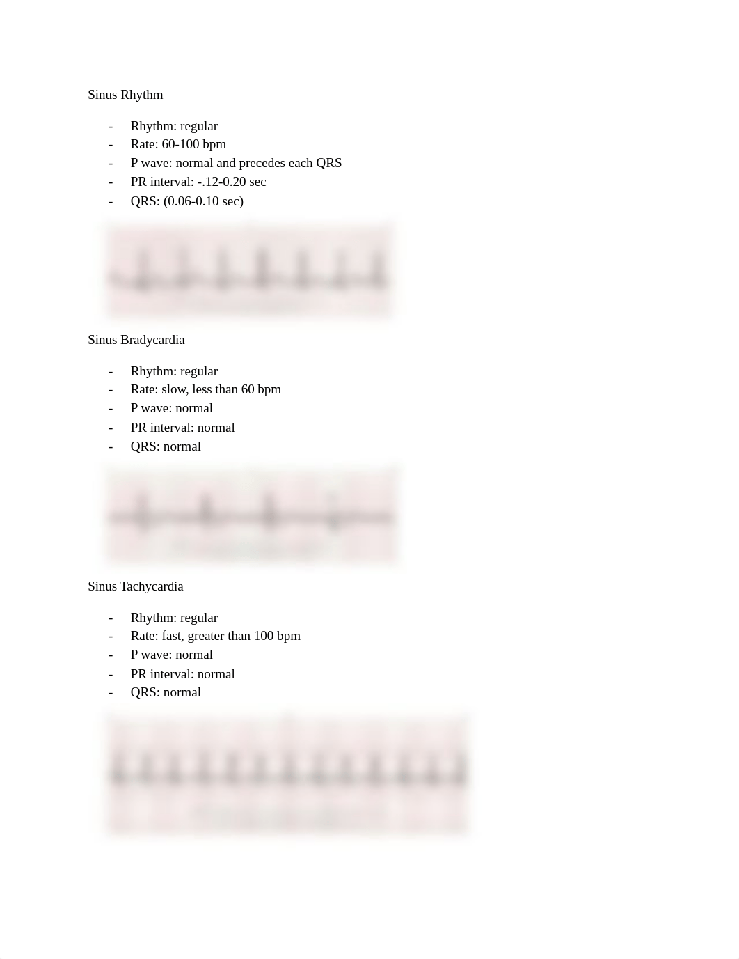 EKG Quiz Rhythms.docx_dhn073ptlqx_page1