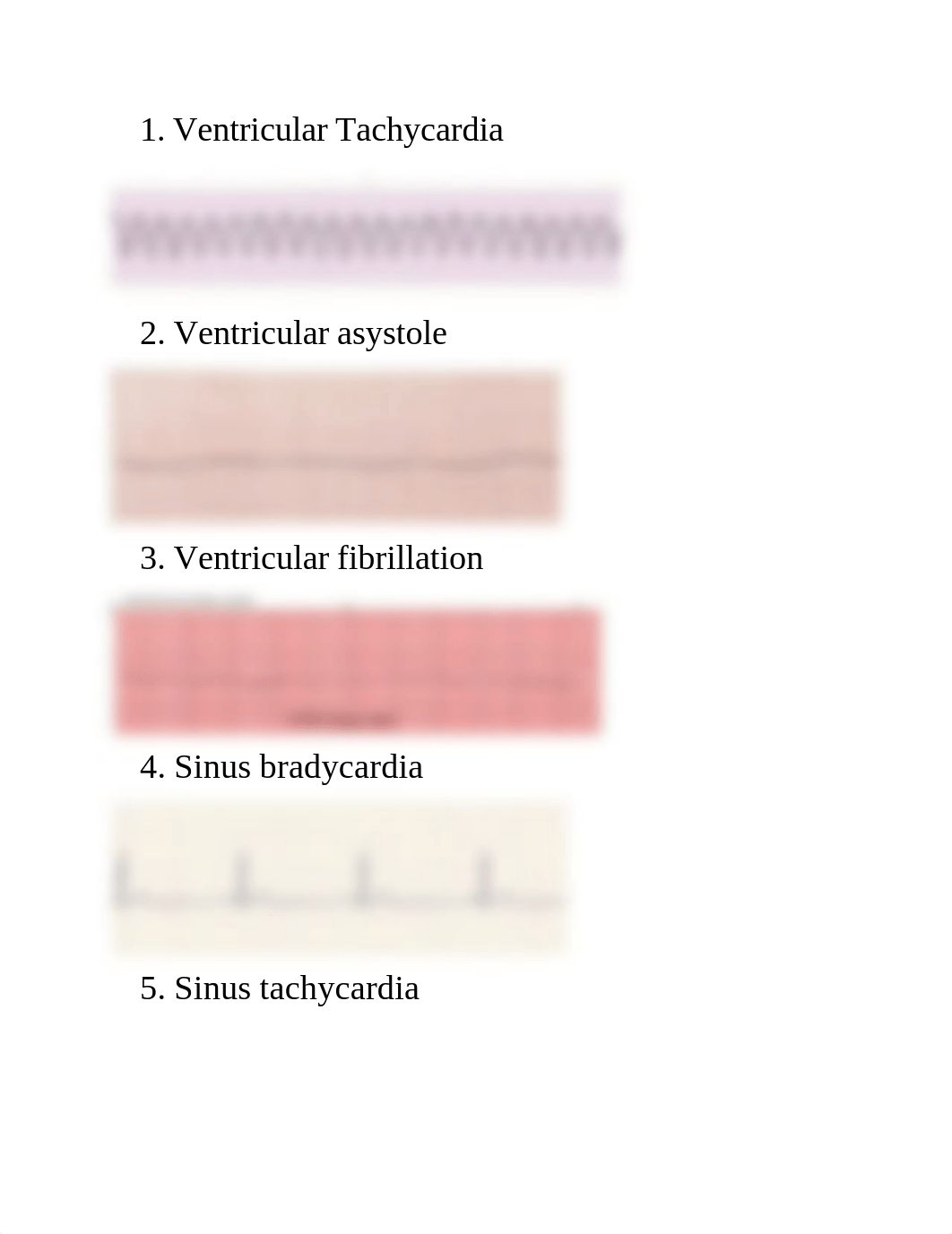 ECG quiz.docx_di8fm17ksr0_page1