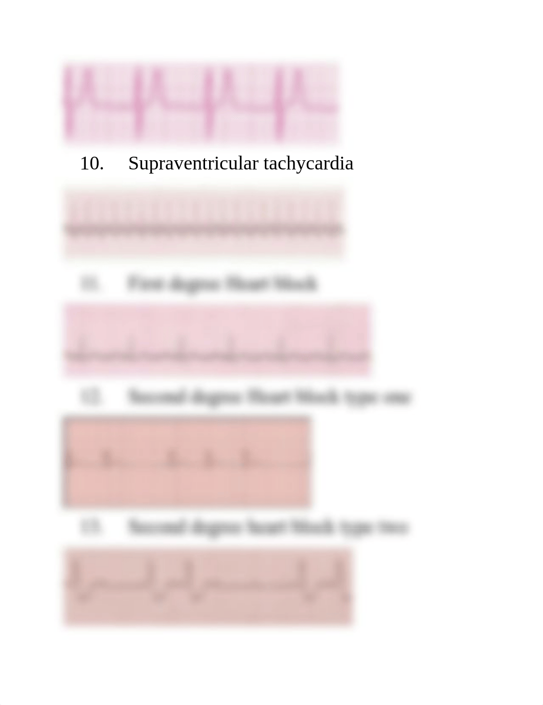 ECG quiz.docx_di8fm17ksr0_page3