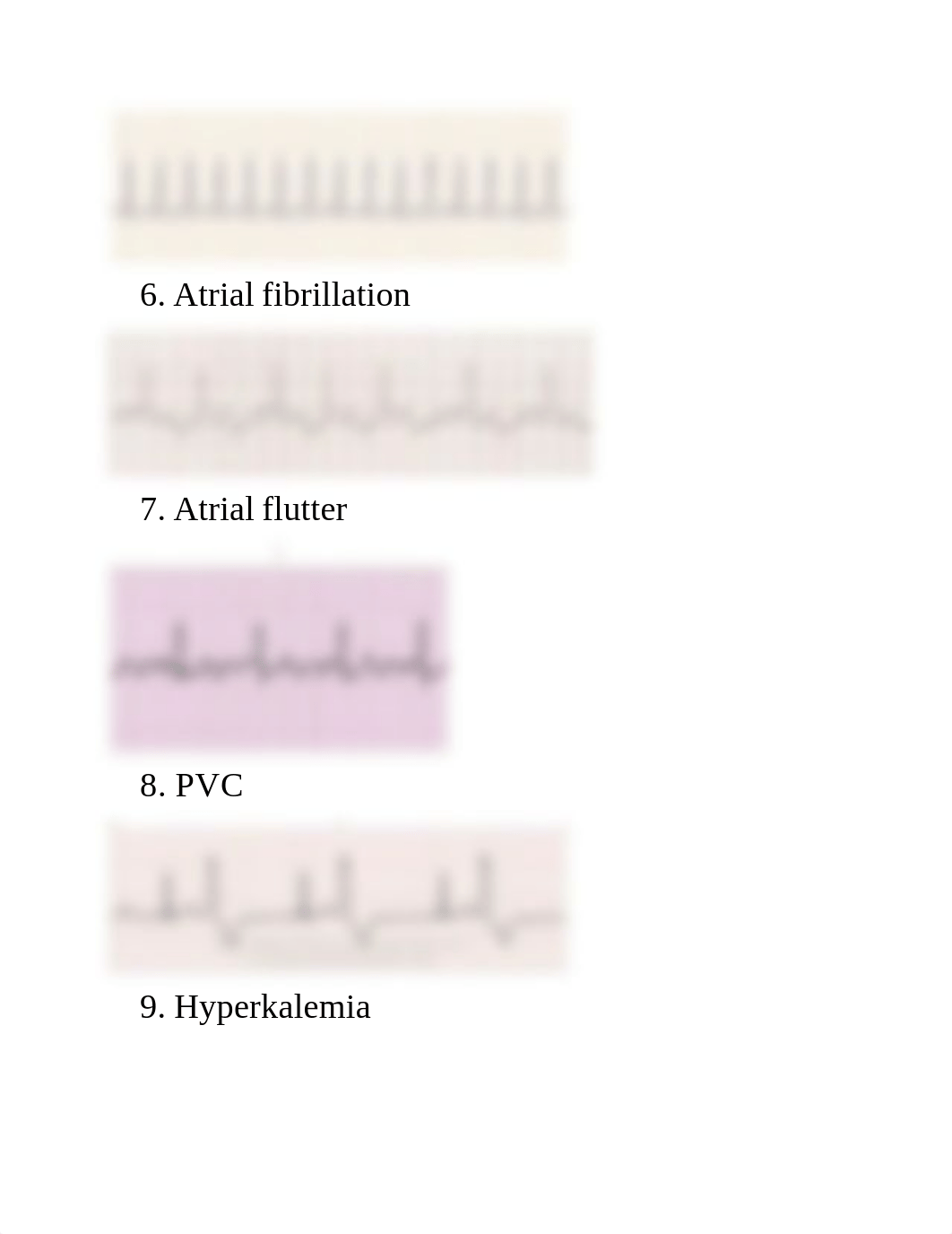 ECG quiz.docx_di8fm17ksr0_page2