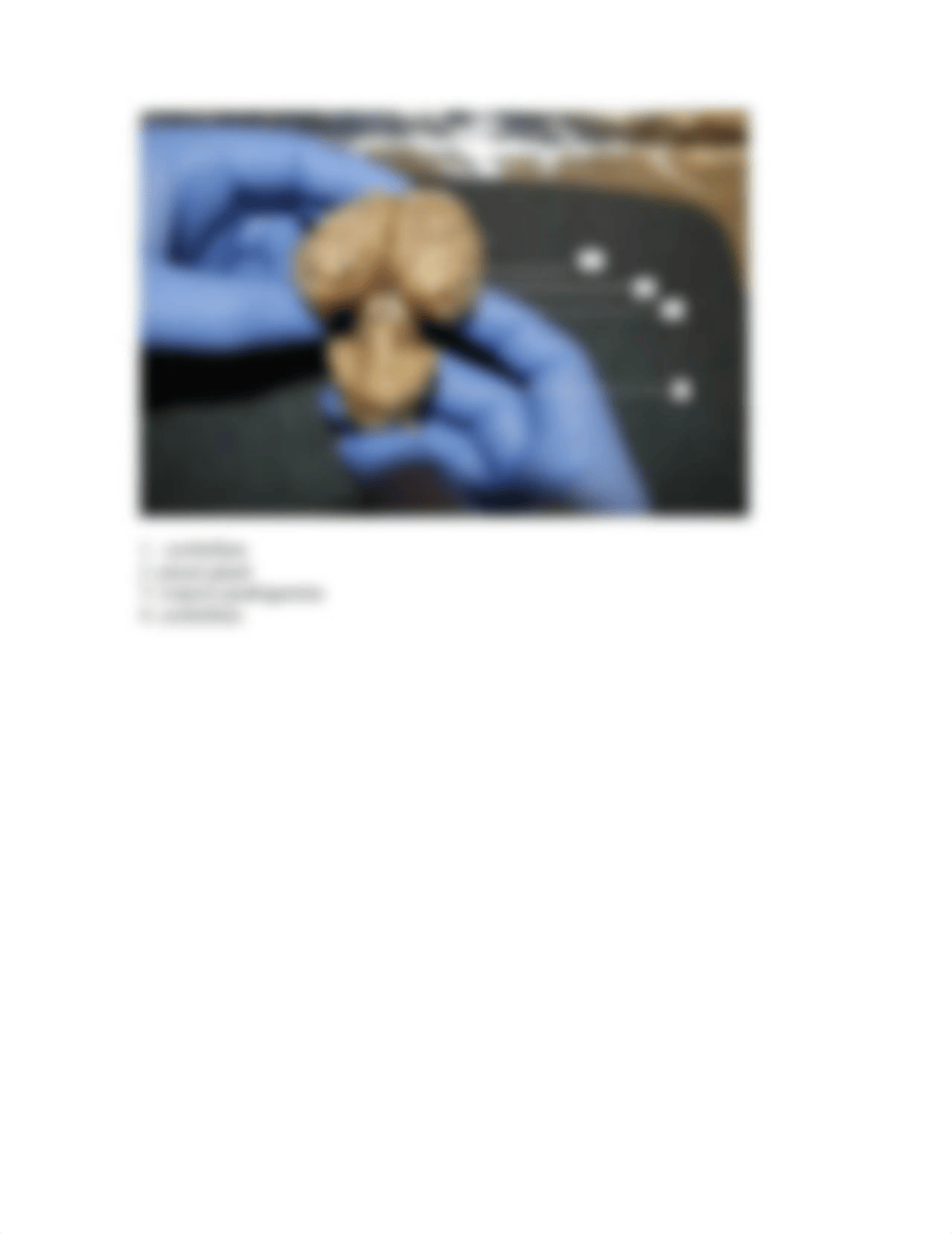 SHEEP BRAIN DISSECTION LABELING EXERCISE (2)_di8jbv25bd0_page4