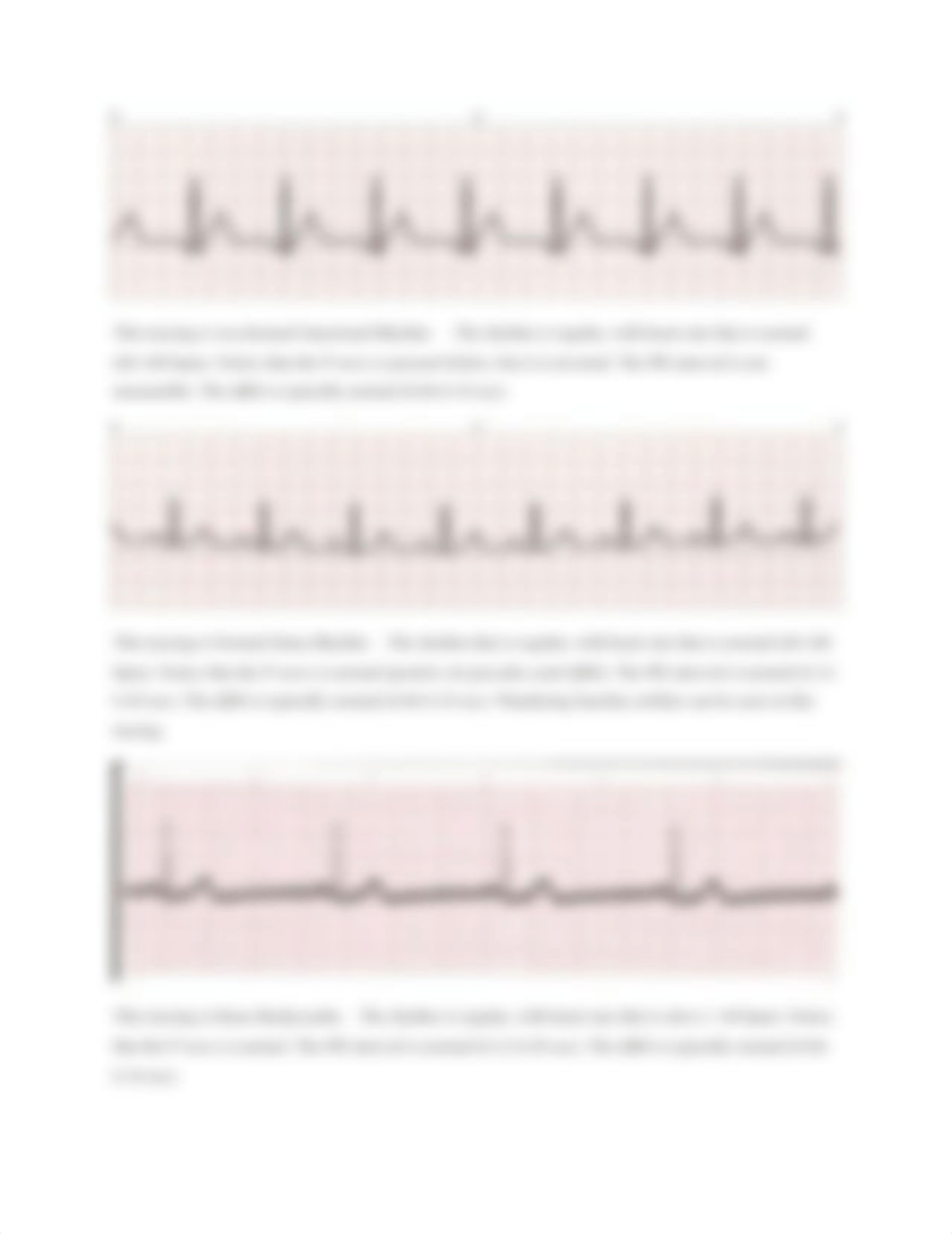 Basic ECG Rhythm.docx_dib9pflyap6_page3