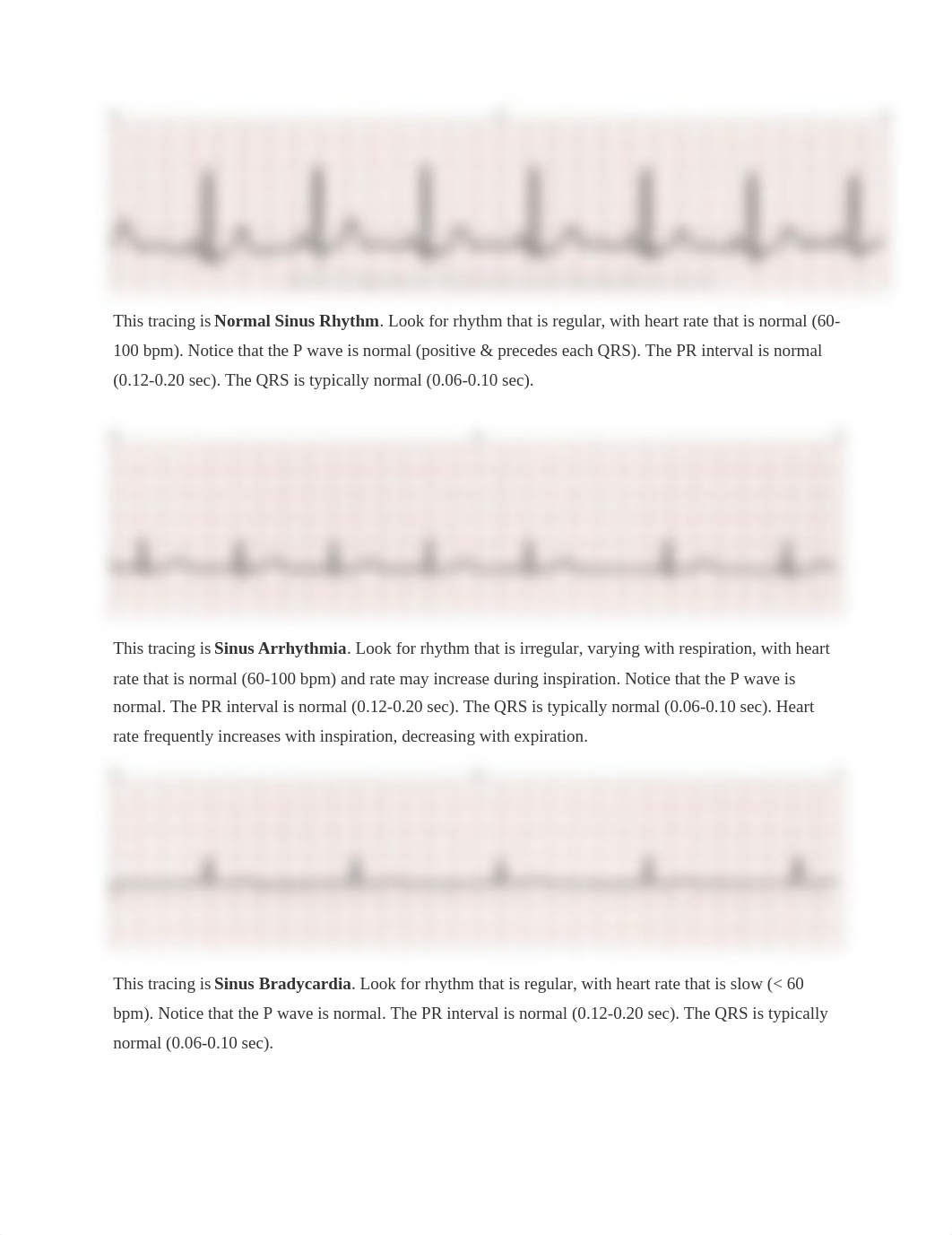 Basic ECG Rhythm.docx_dib9pflyap6_page1