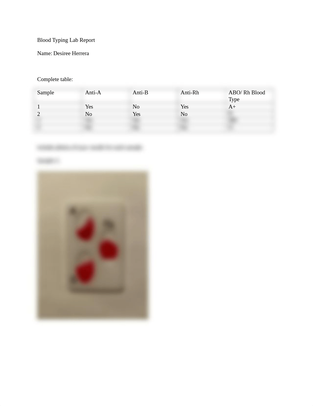 D. Herrera Blood Typing Lab Report.docx_dieq03yw2cd_page1