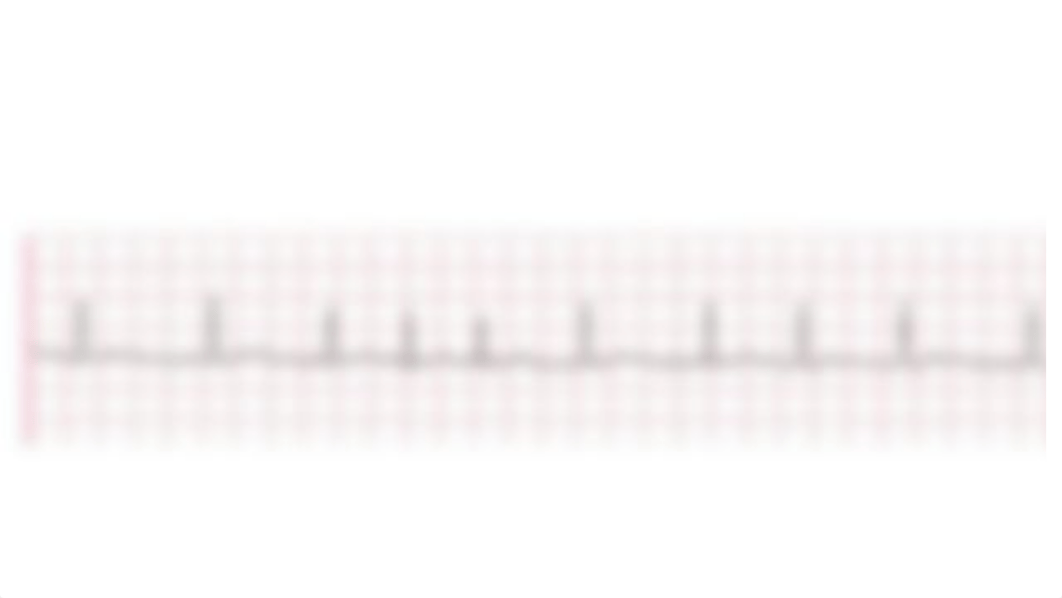 EKG & ABG Practice.pptx_dif2bb392h4_page2