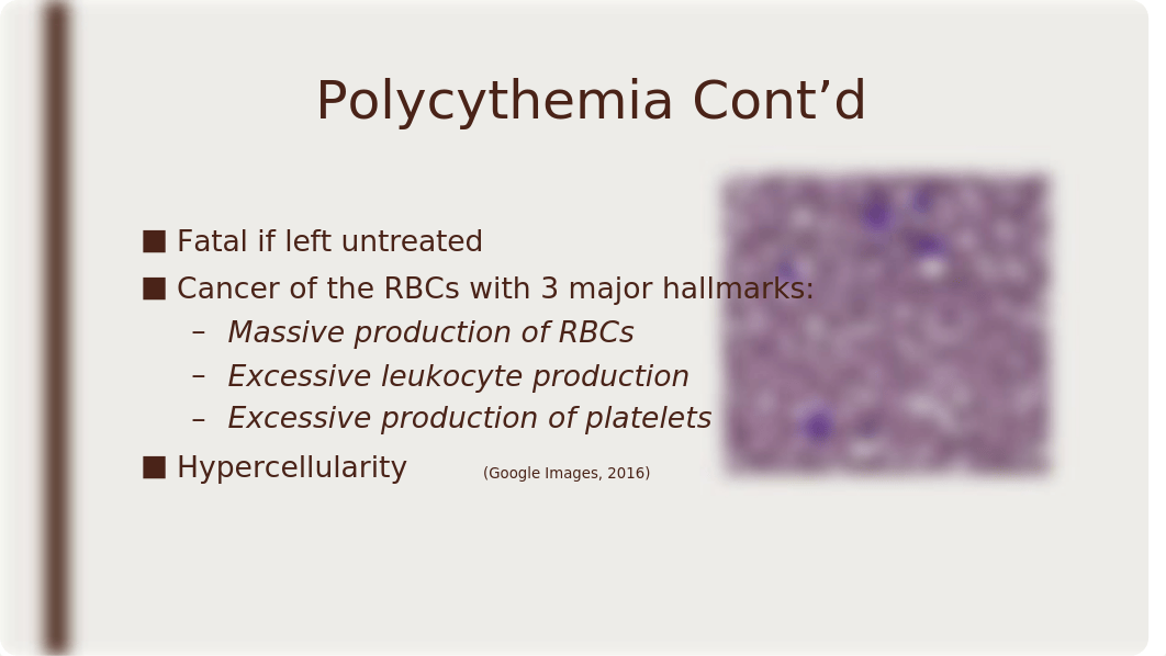 Polycythemia Vera power point cs.pptx_dif7x1pe2eu_page4