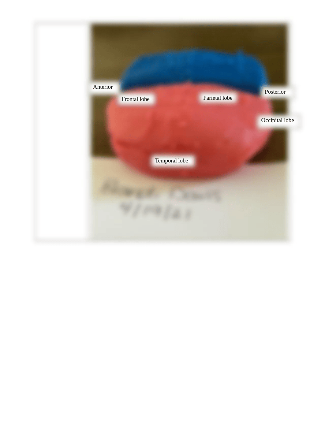 Lab Report 11 - Gross Anatomy of the Central Nervous System.docx_difqon3y9ar_page2