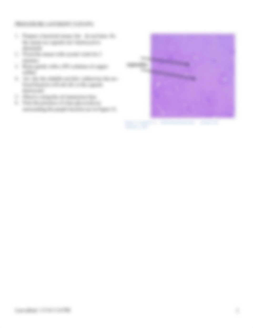 09 Capsule stain.pdf_diohaqb1rbw_page2