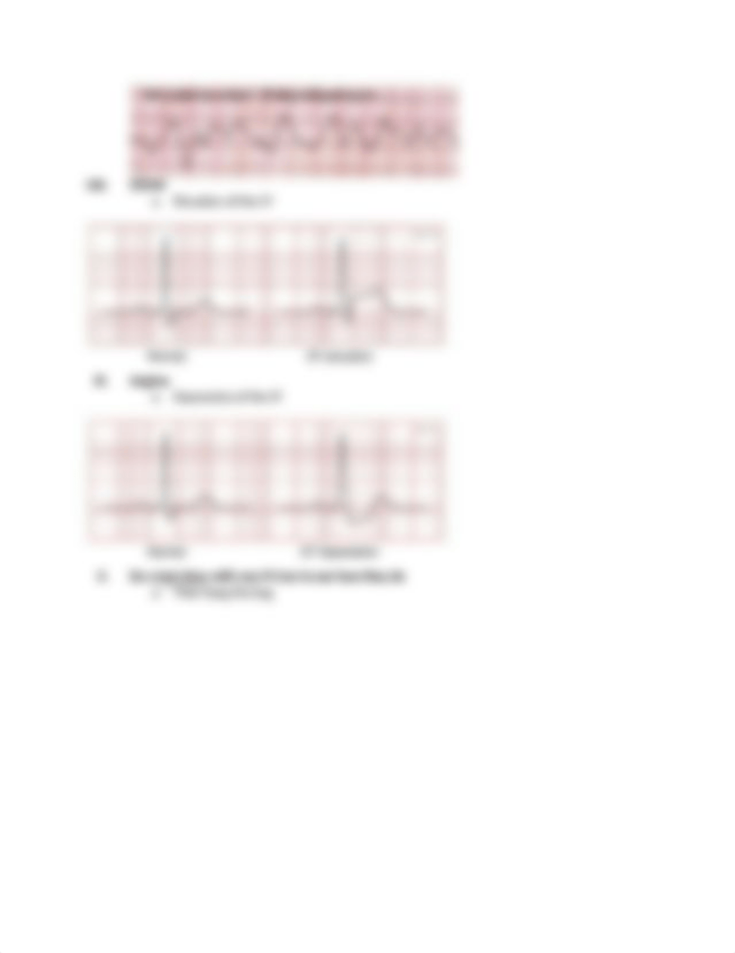 Review of Cardiac Rhythms.docx_diojro5pmld_page2