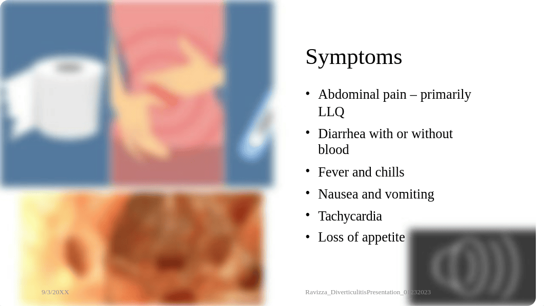 Ravizza_DiverticulitisPresentation_01232023.pptx_disdrbm1x9f_page4